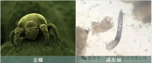 防螨！已成為健康的&ldquo;新剛需&rdquo;--武漢時(shí)間科技推出紡織品防螨整理劑喜化&reg;植螨零